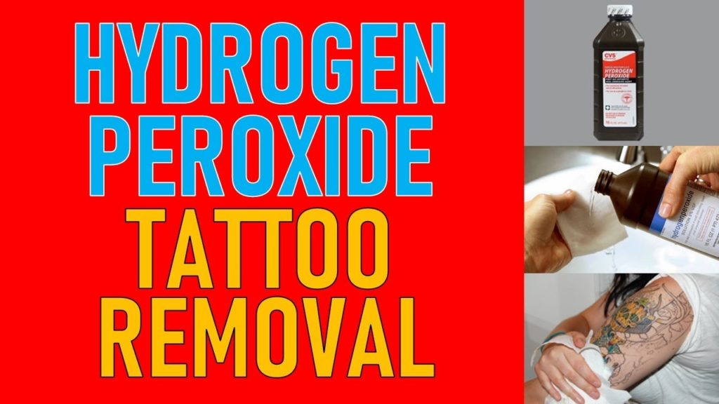 5. Hydrogen Peroxide Tattoo Removal: Before and Aftercare Tips - wide 6