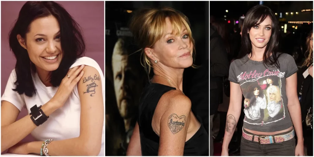 Celebrity Tattoo Removal
